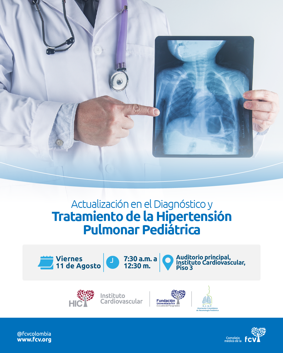 Actualización en el Diagnóstico y Tratamiento de la Hipertensión Pulmonar Pediátrica